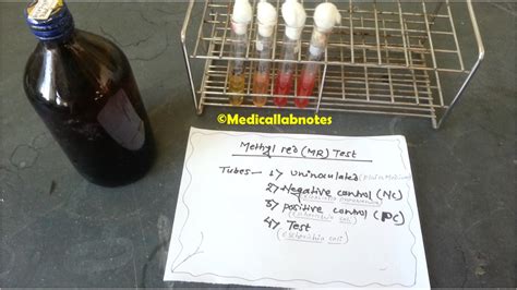 Methyl Red Test: Introduction, Principle, Test Requirements, Test.